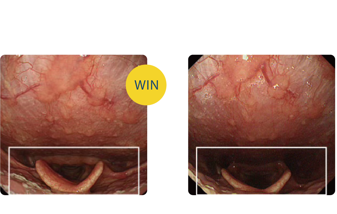 WLI中遠景觀察